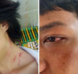 Oknum Satpol PP ‘Membabi Buta’ Pukuli Demonstran, Terkait SK Calon Honorer RS Jantung Oputa Yi Koo Di Sultra
